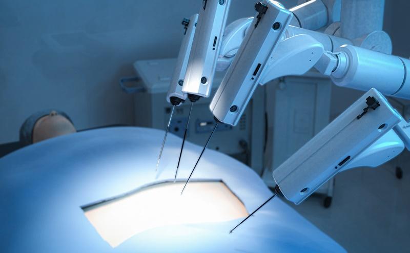 手術支援ロボットのメリットと普及における課題
