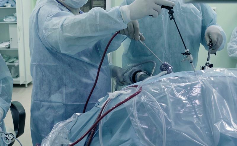 内視鏡下外科手術の限界