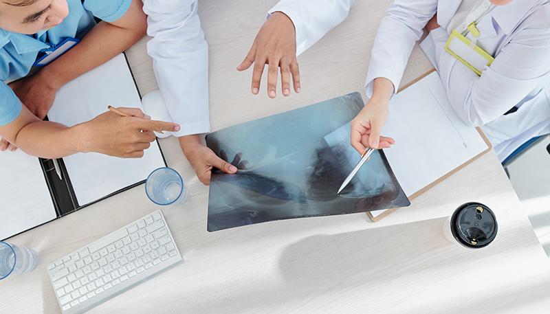 Group of medical workers pointing at chest x-ray and discussing possibility of terminal disease