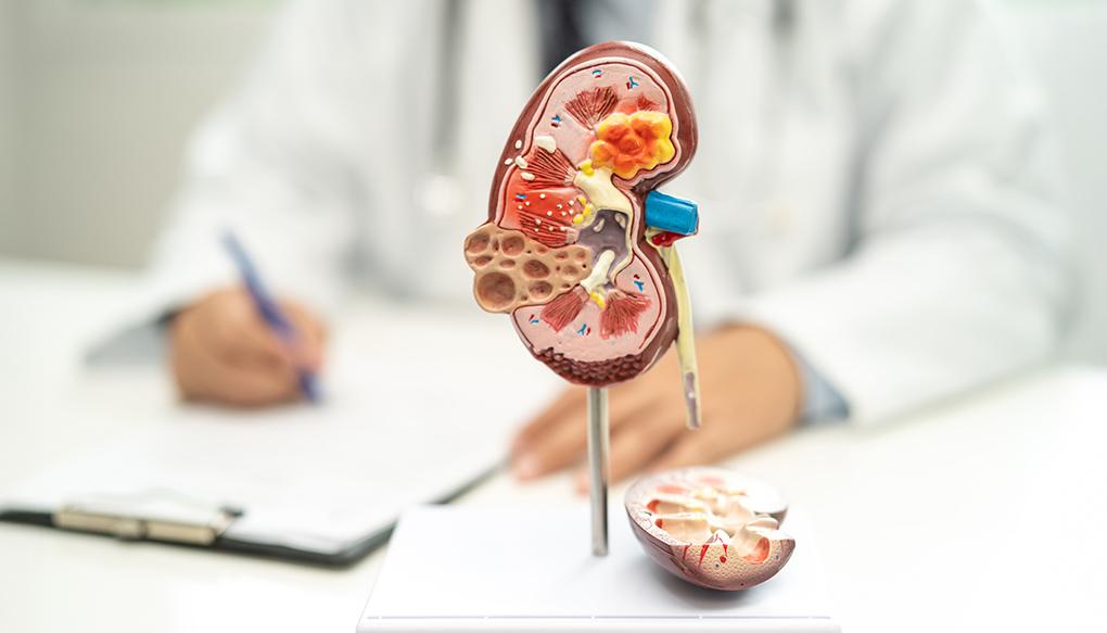 慢性腎臓病の病態を学ぶ医師のイメージ